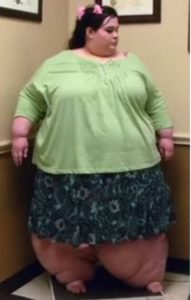 Μια γυναίκα έφτασε να ζυγίζει πάνω από 296 κιλά και όμως τα κατάφερε και  έχασε 180 ολόκληρα κιλά και ξανά κέρδισε την ζωή της
