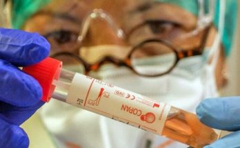 Κινέζικο εμβόλιο για Covid-19: Για πρώτη φορά οι επιστήμονες μήλον για99% πιθανότητες επιτυχίας