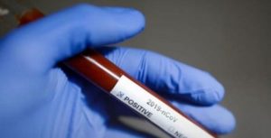 Ερευνά για CoViD-19: Σοβαρότερη η κατάσταση στην ομάδα αίματος Α, πιο ήπια στην ομάδα αίματος Ο