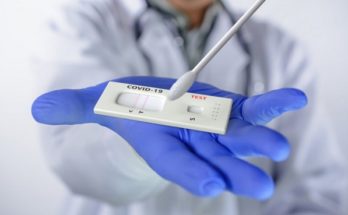 Ηράκλειο Αττικής: Δωρεάν rapid covid tests για ιδιοκτήτες και εργαζόμενους των επιχειρήσεων του Δήμου από το Επαγγελματικού Επιμελητηρίου Αθηνών