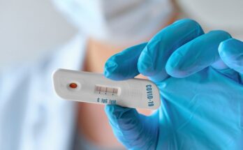 Δωρεάν rapid test στον Δήμο Χαλανδρίου – την Πέμπτη 20 Οκτωβρίου 2022