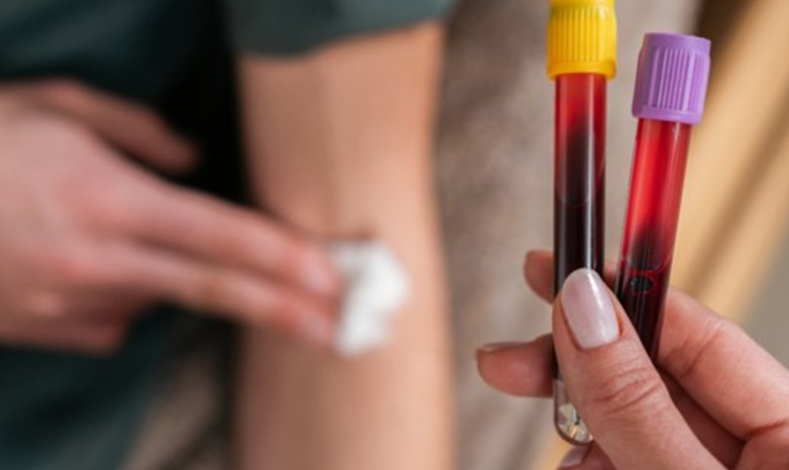 Βριλήσσια: Δωρεάν προληπτικές εξετάσεις για νέους από 18 έως 30 ετών