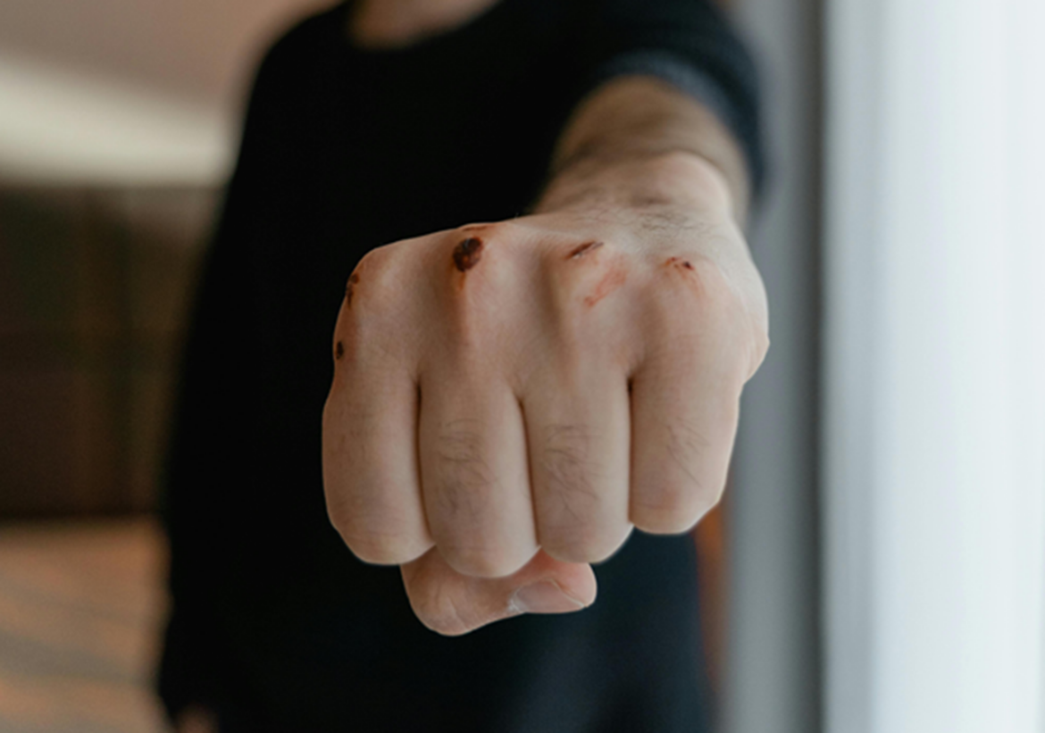 Σοβαρό Περιστατικό Ενδοσχολικής Βίας στη Θεσσαλονίκη: 17χρονος στο Νοσοκομείο